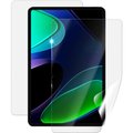 Obrázok pre výrobcu Screenshield XIAOMI Pad 6 fólie na celé tělo